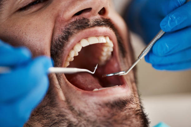 Best Pediatric Emergency Dentist in San Carlos, TX